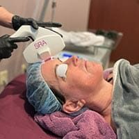 allura-fotofacial-thumbnail